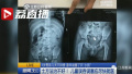 南京3岁男童把玩具狗塞进肛门　爸妈竟拼命喂韭菜