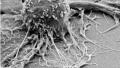 美媒：新式癌症免疫疗法显奇效 使患者拥有更强大T细胞