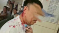 哈尔滨男子服药后过敏　持剪刀从背后突袭医生被拘